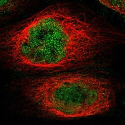 KCTD10 Antibody, Novus Biologicals:Antibodies:Primary Antibodies